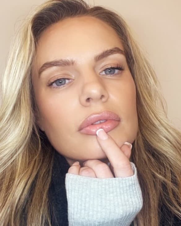Instagram post from MCM Aesthetics & Dermatology