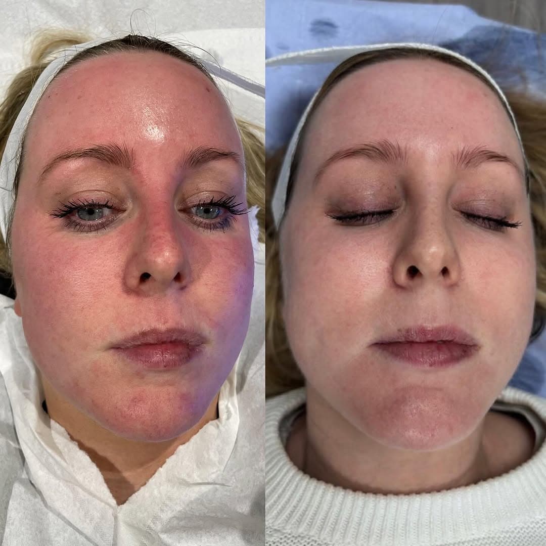 Instagram post from MCM Aesthetics & Dermatology